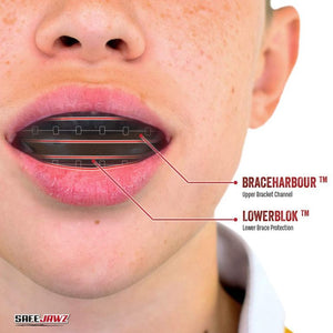 Safe Jawz Mouthguard | Multiple Colours